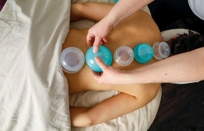 photo of woman receiving cupping massage
