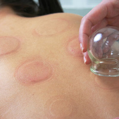 Cupping_153900102_web_crop